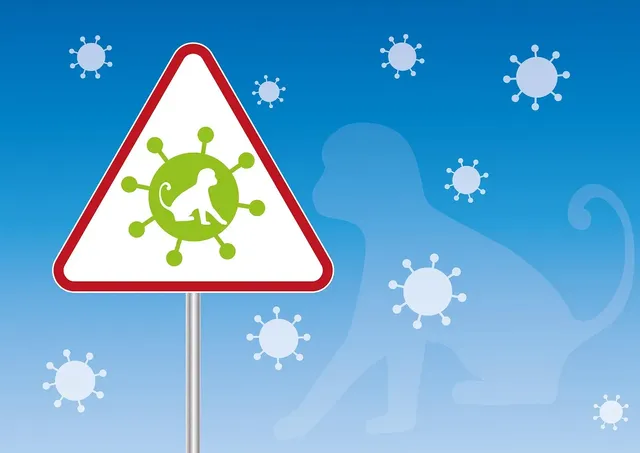 Bulgaria began to be affected by monkeypox