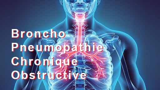 La bronchopneumopathie chronique obstructive tue en France